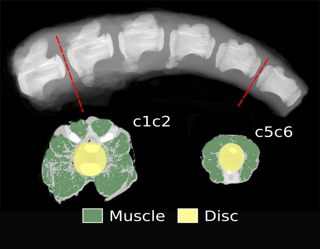 X-ray of spine.