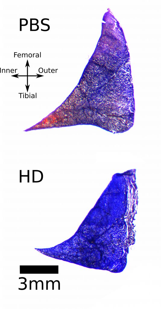 A representation of meniscus mechanics.