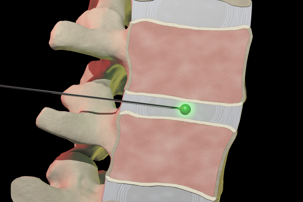 Cross section of a spine.