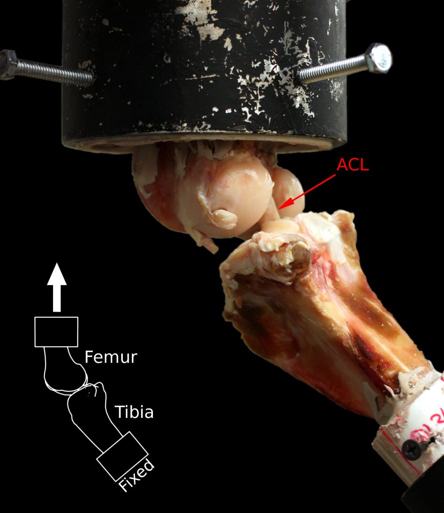 Picture of the bones and ligaments in a human knee.
